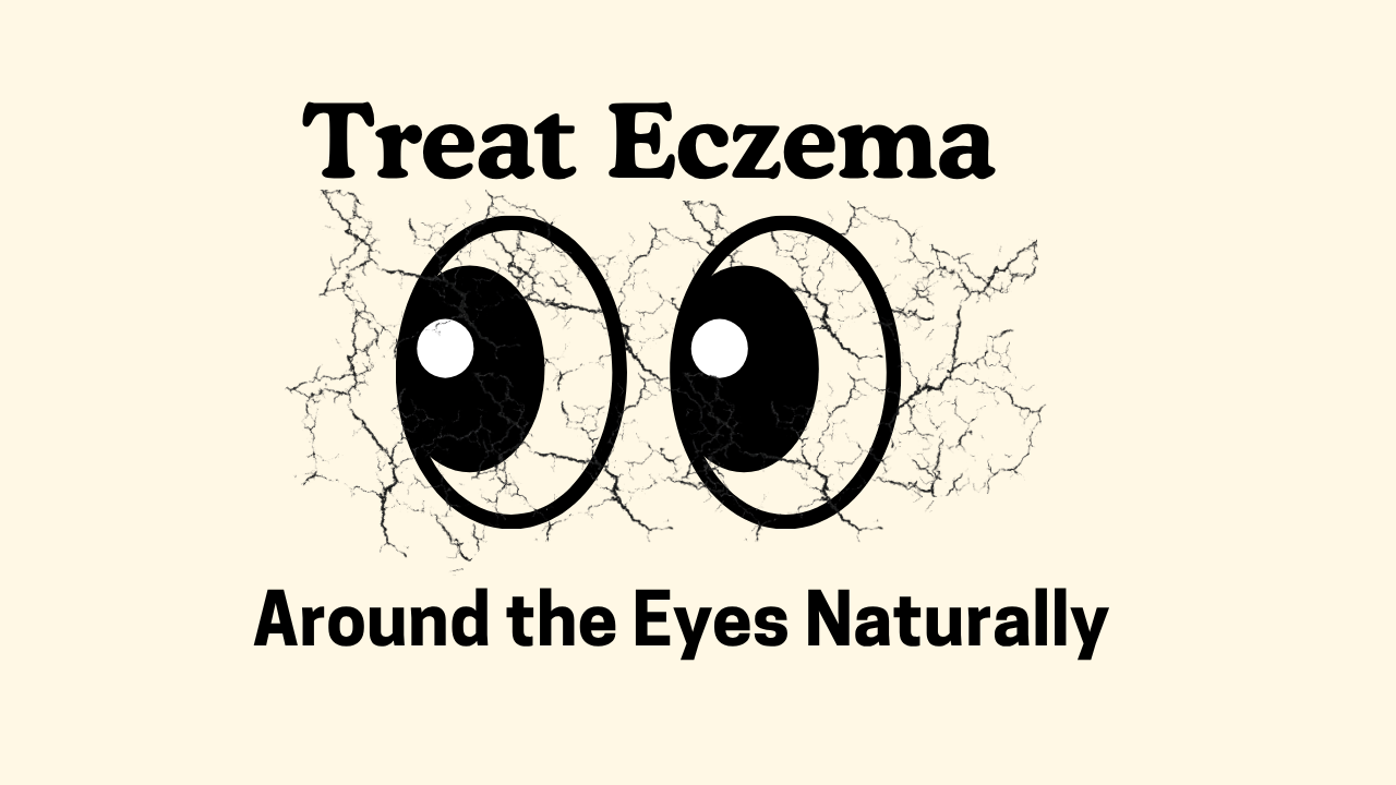 7 Best Ways to Treat Eczema Around the Eyes Naturally