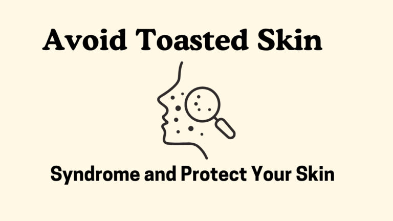 Effective Ways to Avoid Toasted Skin Syndrome and Protect Your Skin