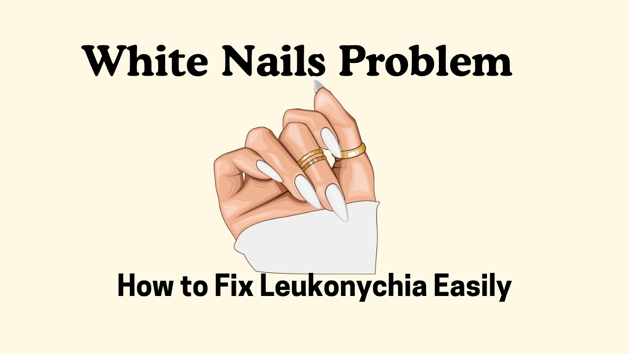White Nails Problem? Here’s How to Fix Leukonychia Easily