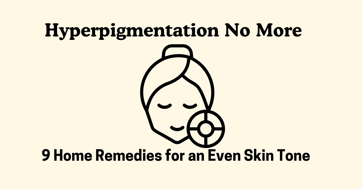 Hyperpigmentation No More! 9 Home Remedies for an Even Skin Tone