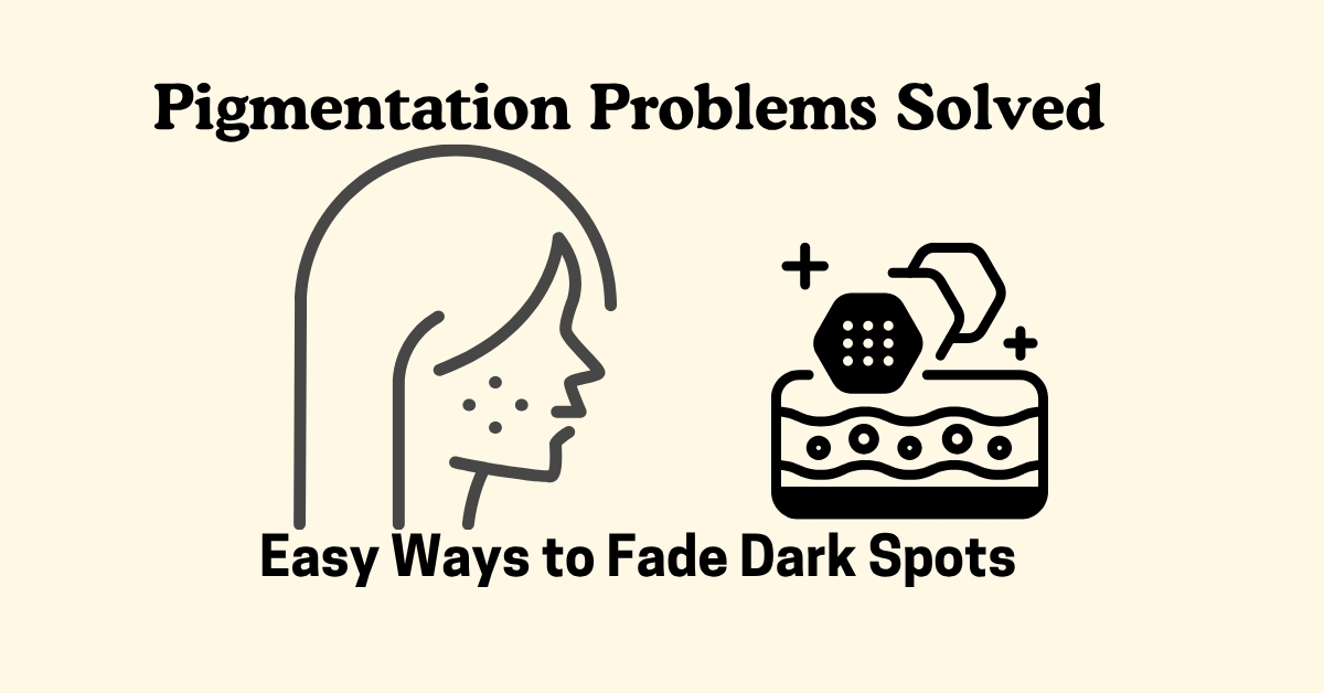 Pigmentation Problems Solved – Easy Ways to Fade Dark Spots