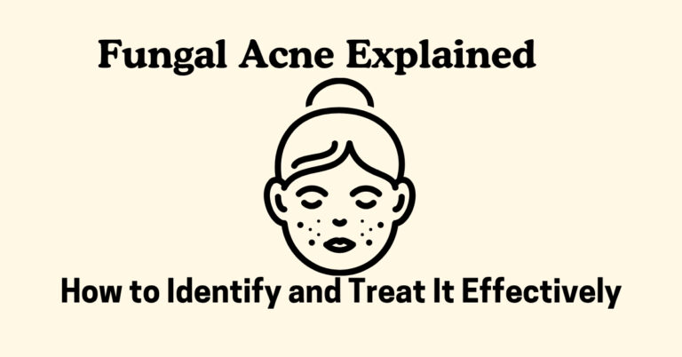 Fungal Acne Explained – How to Identify and Treat It Effectively